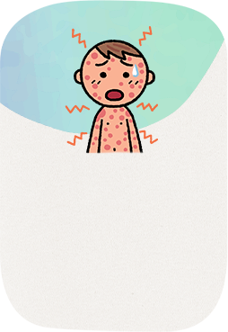 アナフィラキシーってこんな病気