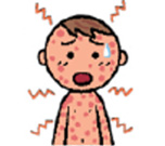 皮膚・粘膜症状のイメージイラスト